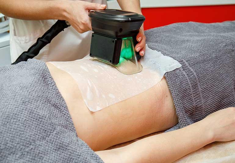 آیا کرایولیپولیز برای شما مناسب است؟